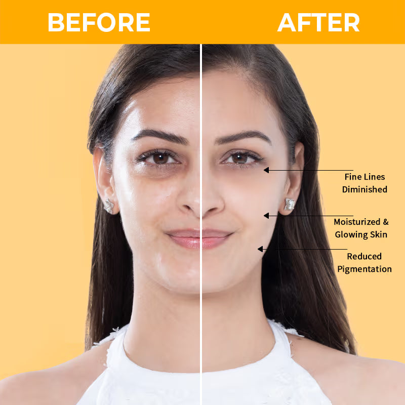 Nykaa SkinRX Illuminate+ Vitamin C Day Moisturizer SPF 15 for Radiant, Hydrated Normal to Dry Skin (50 gm)