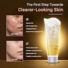 Ozone Acne Check Face Wash